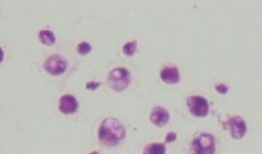 脑膜刺激征检查视频,直观解析临床诊断技巧